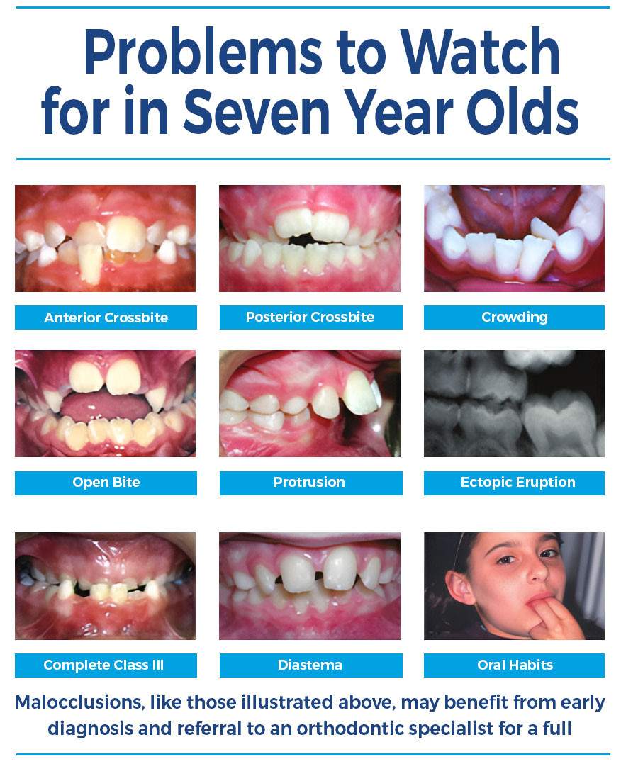 Early-treatment-graphic